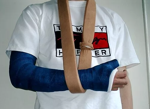 Cast