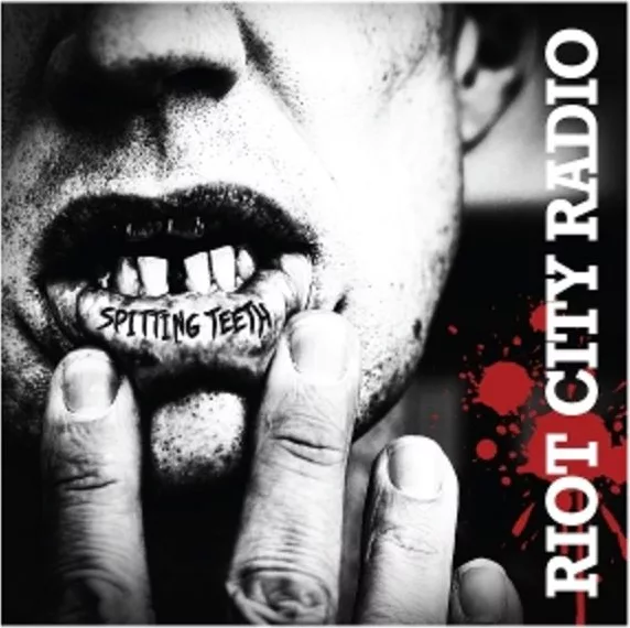 Riot City Radio — Spitting Teeth