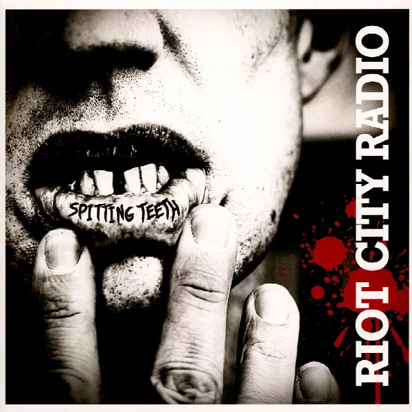Riot City Radio — Spitting Teeth
